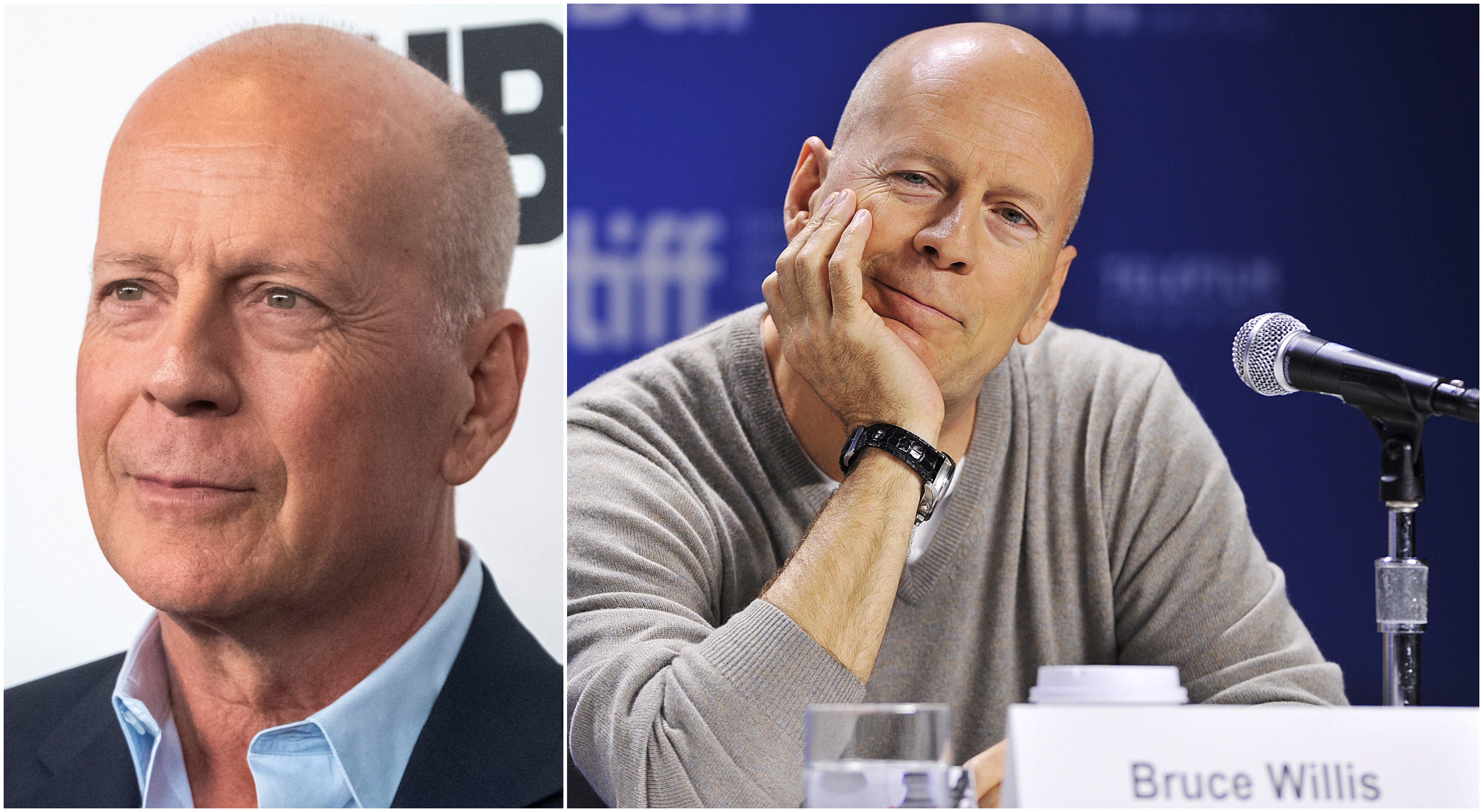 Bruce Willis, Kändis, Sjukdom